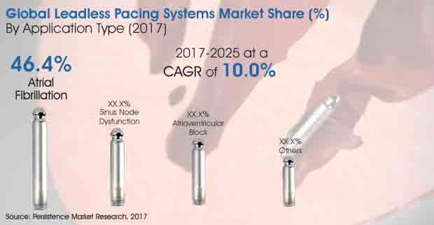 Leadless Pacing Systems Market